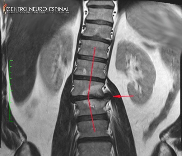 Michael Simons Spine